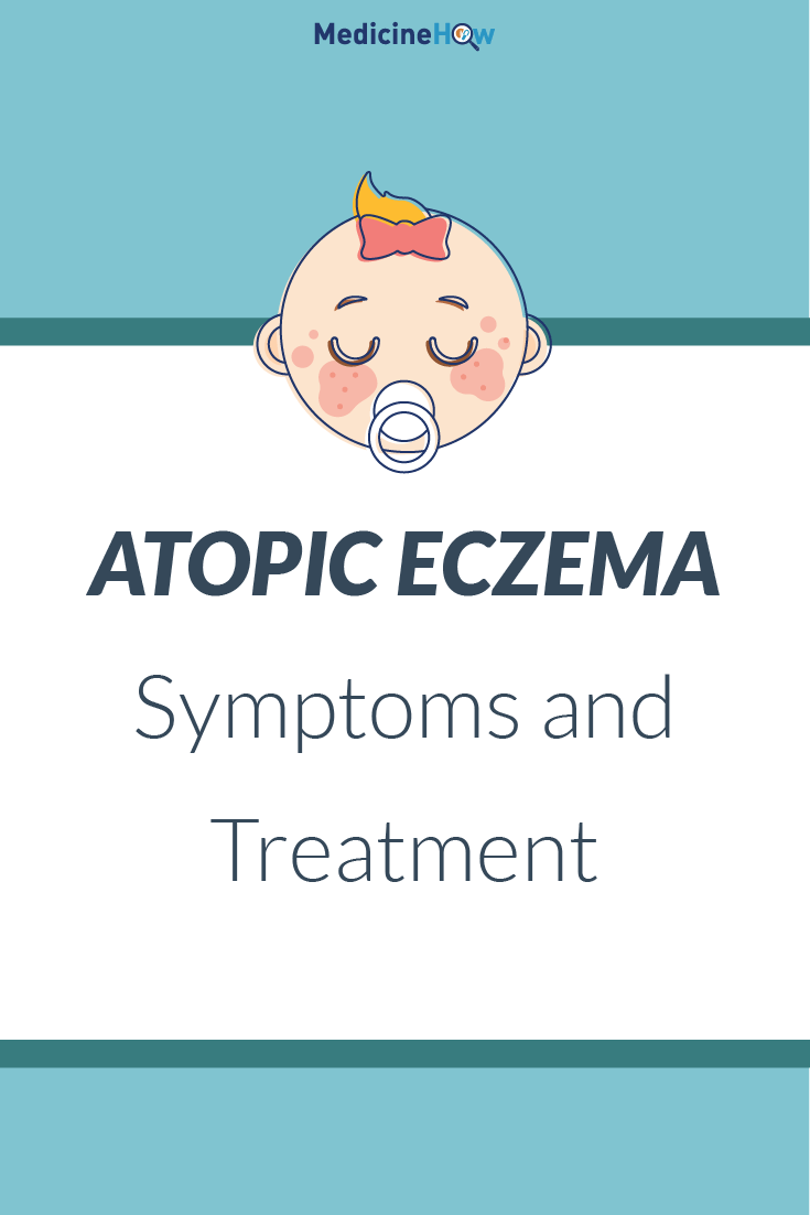 Atopic Eczema Symptoms and Treatment