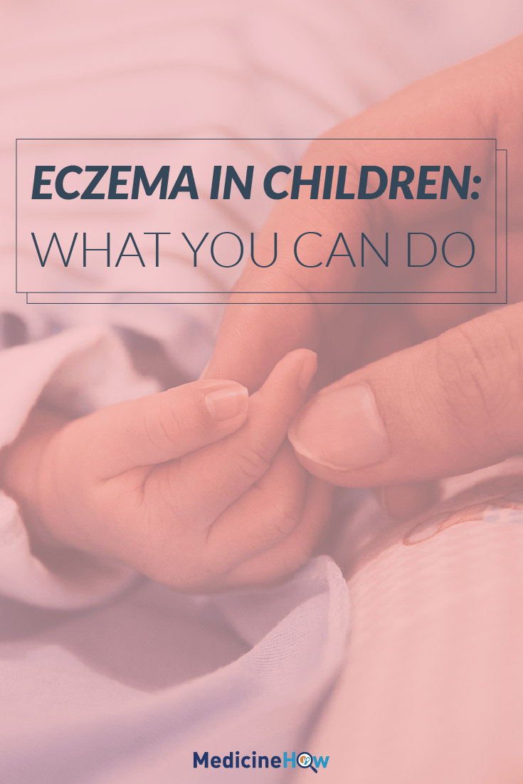 Eczema in Children: What You Can Do