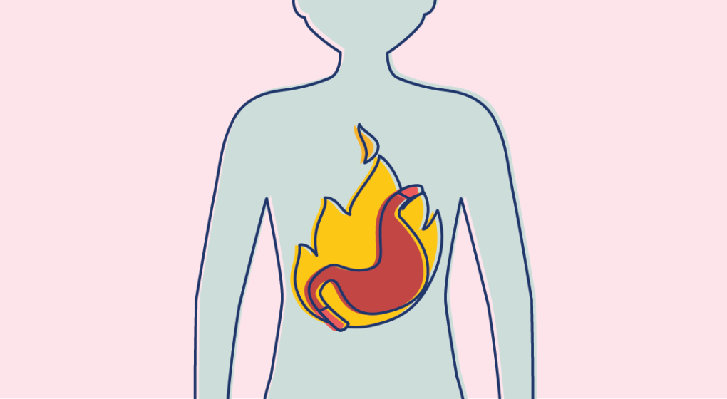 Antiacids Heartburn
