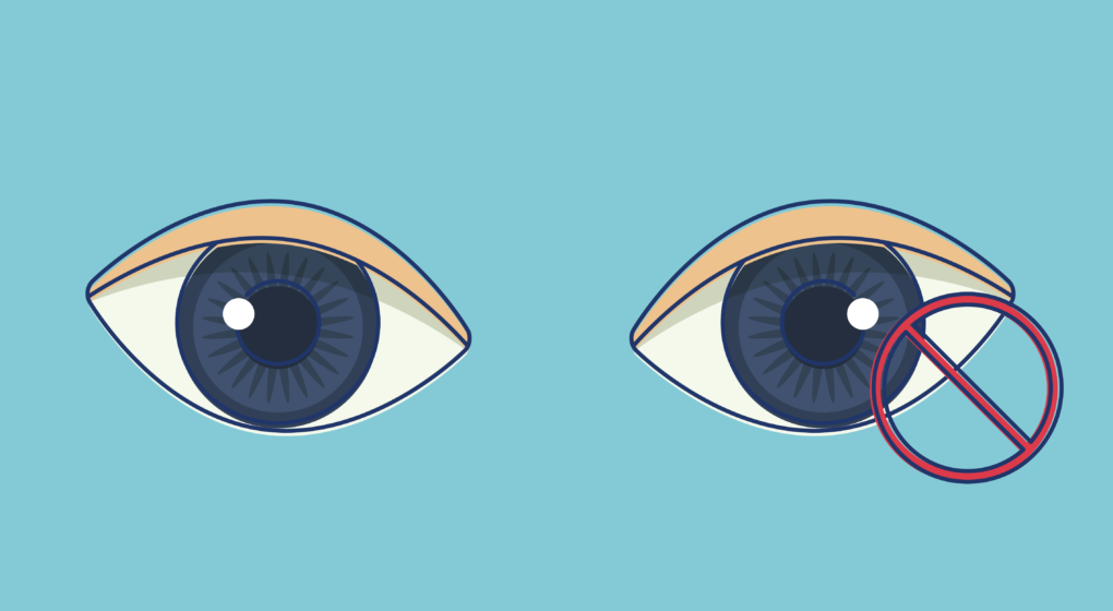 Blindness From Trachoma